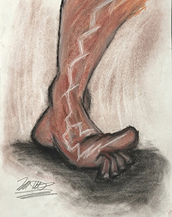 Charcoal sketch of a reddened leg with electricity shooting down from the shin into the foot and toes.