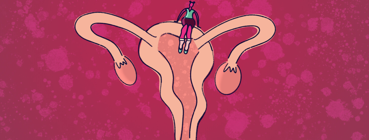 a woman with wiggly legs sits on top of a uterus
